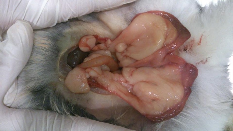 Tumore der Gebärmutter.