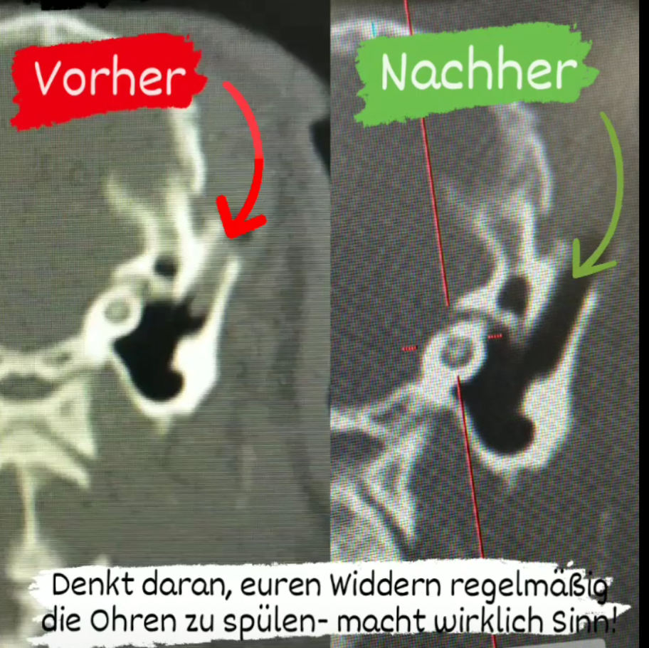 Das Bild zeigt zwei CT Aufnahmen des Ohrs, vor Beginn der Ohrreinigungen und danach. Im Nachher-Bild ist zu sehen, dass das Ohr wieder deutlich besser belüftet ist.